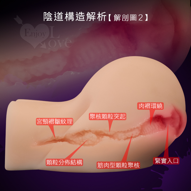 側面陰道構造解析【解剖圖】- 宮頸褶皺紋理/顆粒分布結構/聚核顆粒突起/筋肉型顆粒聚核/肉褶環繞/緊實入口